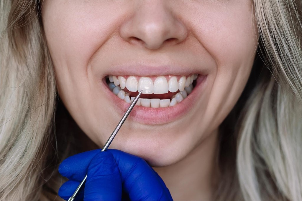 ¿Qué alimentos dañan el esmalte dental?